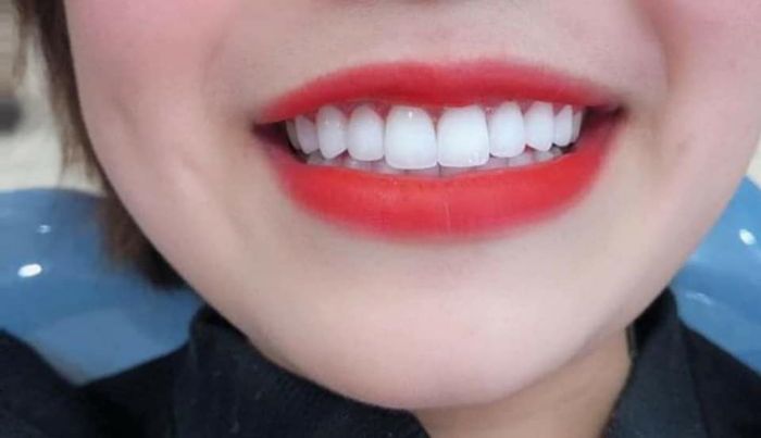 Hình ảnh 1 về Nha Khoa Tân Thành Bình