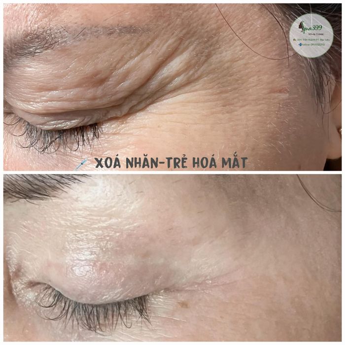 Hình ảnh không gian thư giãn tại 399 Spa