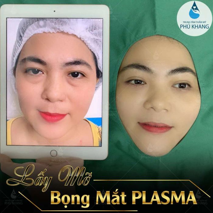 Thẩm mỹ Phú Khang ảnh 1