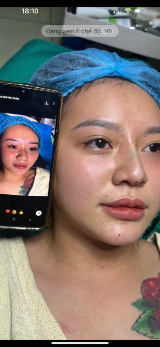 Hệ thống máy móc hiện đại tại Minh Châu Spa