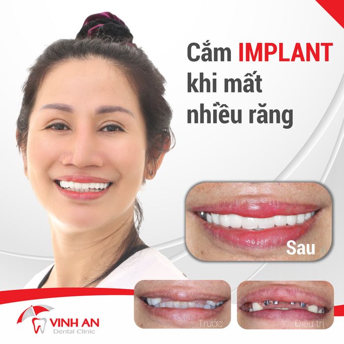 Hình ảnh không gian hiện đại tại Nha Khoa Vinh An