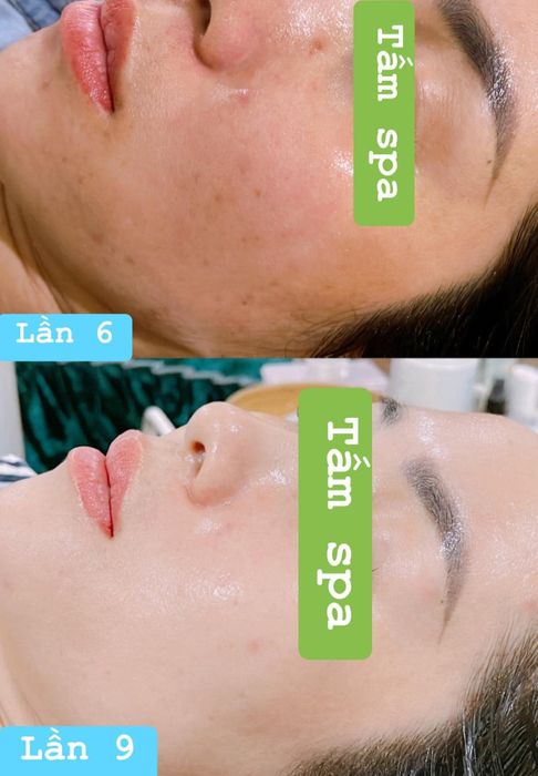 Hệ thống máy móc hiện đại tại Tấm Spa