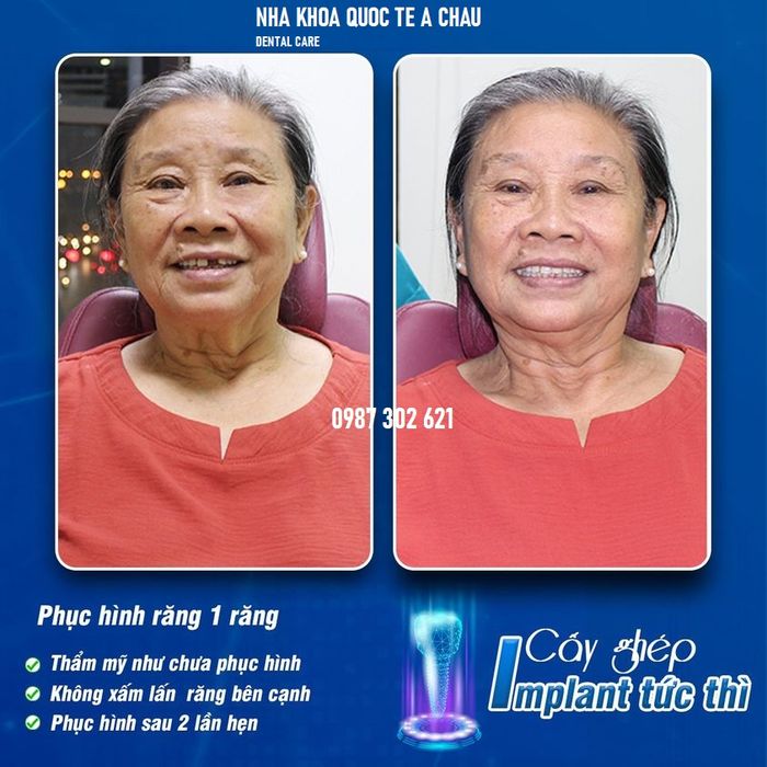 Hình ảnh phòng khám đạt chuẩn quốc tế tại Nha khoa Á Châu