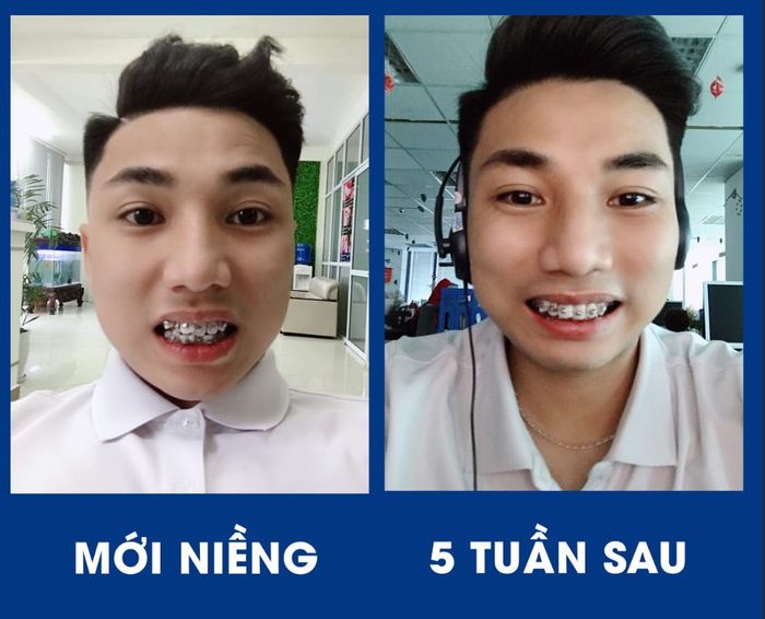 NHA KHOA VIỆT ANH ảnh 1