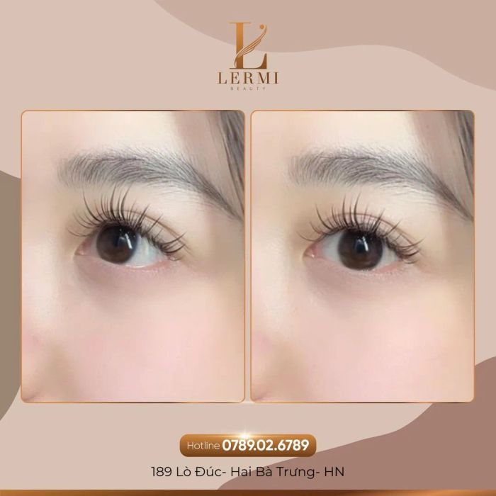 Lermi - Beauty hình ảnh 2