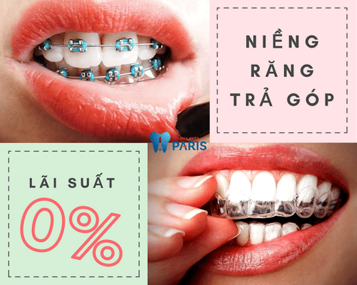 Hệ thống trang thiết bị tân tiến tại Nha Khoa Paris