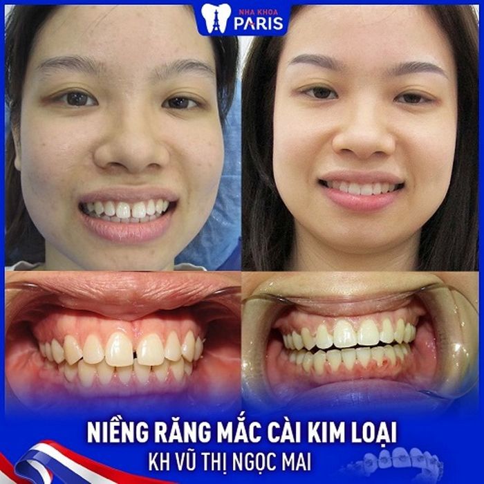 Không gian hiện đại tại Nha Khoa Paris