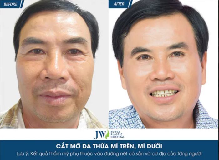 Bệnh viện thẩm mỹ JW Hàn Quốc ảnh 2