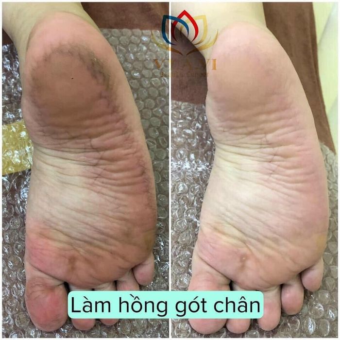 Không gian sang trọng và dịch vụ chuyên nghiệp tại VY.A.VI Spa