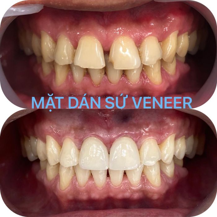Hệ thống trang thiết bị tân tiến tại Nha Khoa Miền Tây