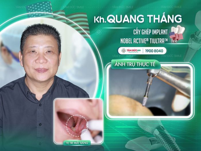 Hệ thống robot định vị X-Guide hiện đại tại Nha Khoa Tâm Đức
