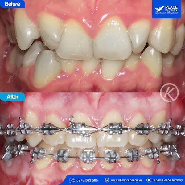 Không gian hiện đại tại Peace Dentistry