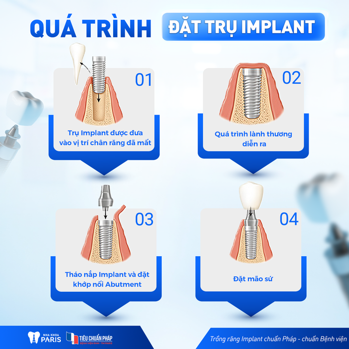 Hình ảnh phòng khám đạt chuẩn Pháp tại Nha Khoa Paris