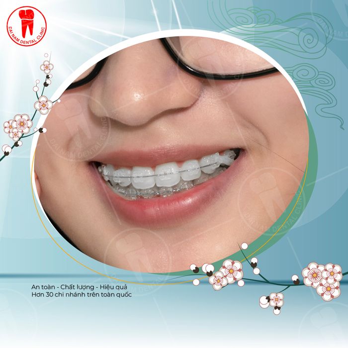 Hệ thống trang thiết bị hiện đại tại Nha khoa Đại Nam