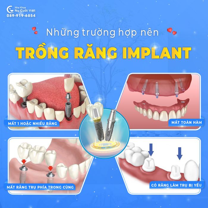 Khoảnh khắc chuyên nghiệp tại Hệ thống Nha Khoa Thẩm Mỹ Nụ Cười Việt – ảnh 2