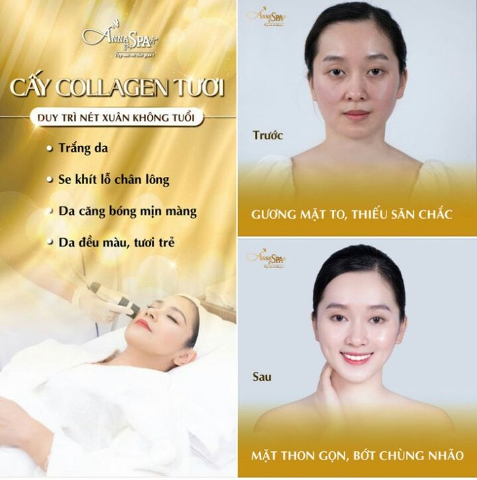 Không gian điều trị tại Thẩm Mỹ Viện Anna Spa