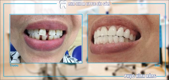 Nha Khoa Little Sài Gòn – Hình ảnh minh họa không gian hiện đại và tinh tế