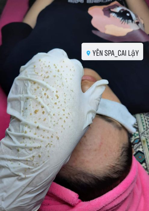 Quy trình điều trị chuẩn Hàn Quốc tại Yên Spa
