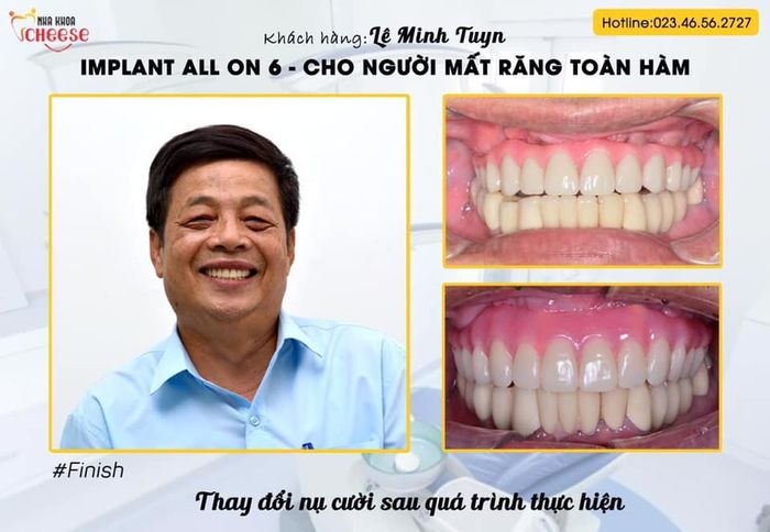 Khoảnh khắc chăm sóc khách hàng tại Nha Khoa Cheese ảnh 2