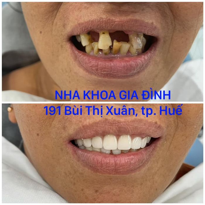 Khoảnh khắc khách hàng rạng rỡ sau điều trị tại Nha khoa Gia Đình ảnh 2