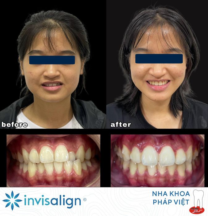 Hình ảnh phòng khám Nha Khoa Pháp Việt Huế – Toàn cảnh dịch vụ hiện đại và chuyên nghiệp