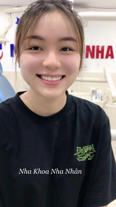 Nha Khoa Nha Nhân ảnh 1