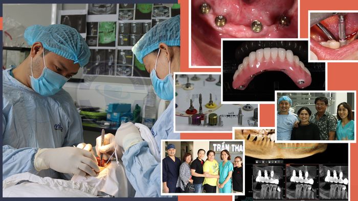 Hệ thống máy móc tối tân đạt chuẩn quốc tế tại Nha Khoa Châu Long