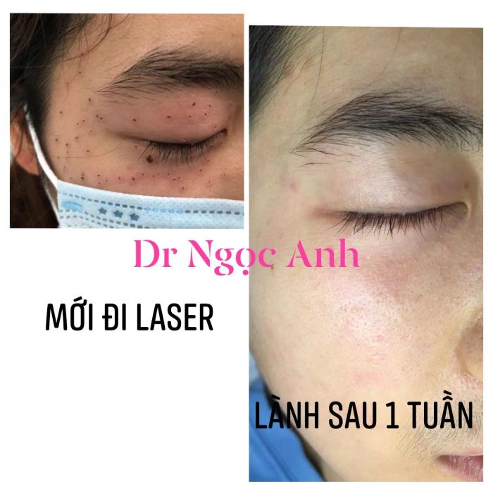 Dr. Ngọc Anh - Da liễu và Thẩm mỹ ảnh 1