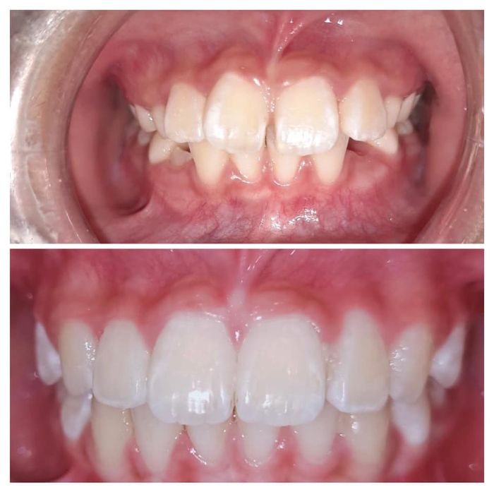 Hình ảnh thực tế về NHA KHOA ĐĂNG KHOA