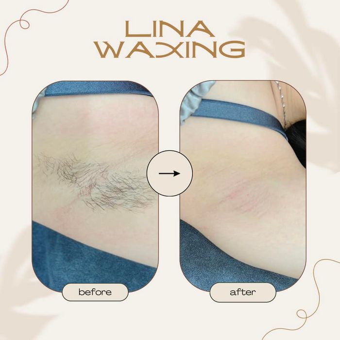 Hình ảnh minh họa dịch vụ waxing (Nguồn: Internet)