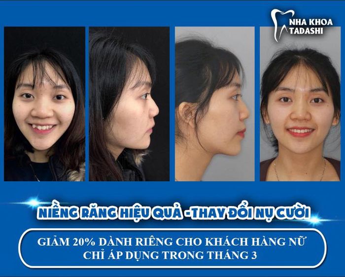 Hình ảnh tại Nha Khoa Quốc Tế Tadashi