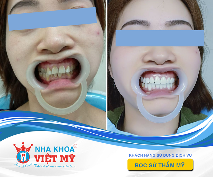 Không gian phòng khám hiện đại tại Nha Khoa Việt Mỹ Tuy Hòa