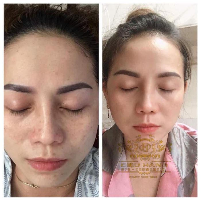 Quy trình chăm sóc da chuyên nghiệp tại Diệu Hằng Spa