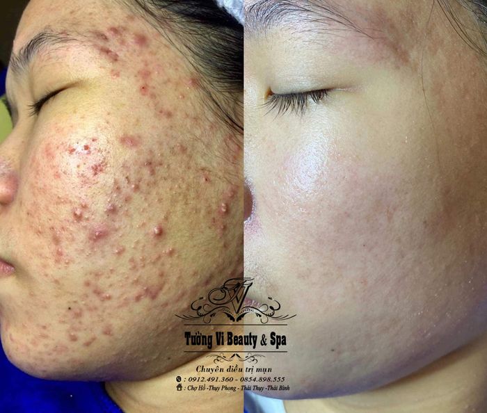Không gian sang trọng và đẳng cấp tại Tường Vi Beauty Spa