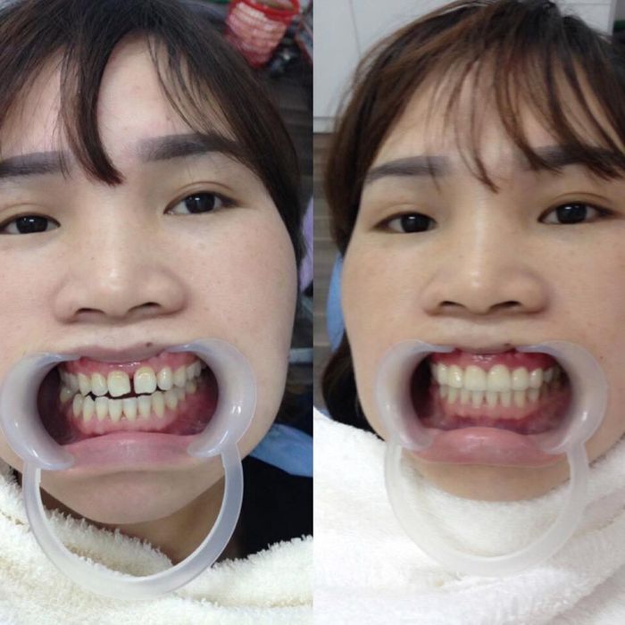 Hình ảnh tại NHA KHOA QUỐC TẾ VIỆT ĐỨC