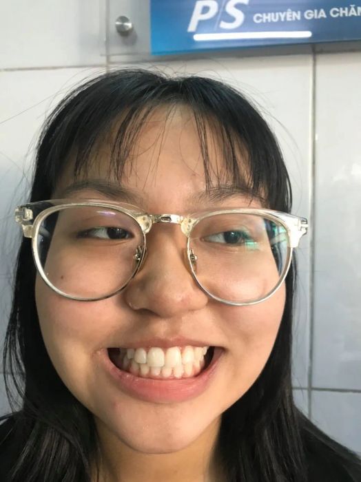 NHA KHOA THỦ ĐÔ - Chuyên gia bọc răng sứ thẩm mỹ