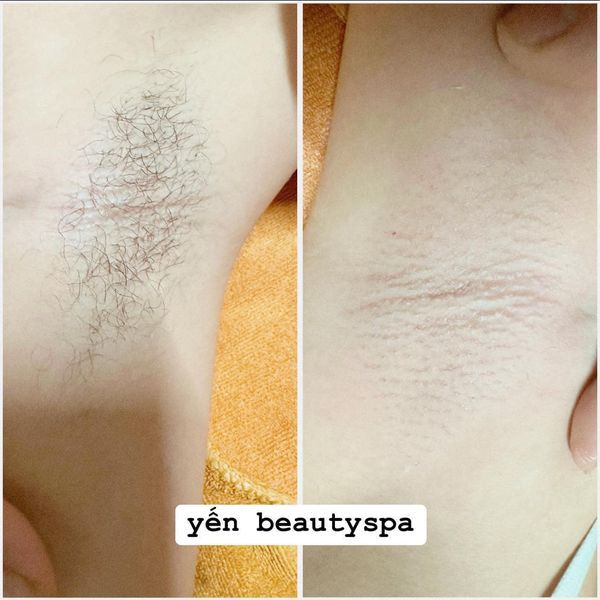 Quy trình waxing chuyên nghiệp tại Yến Beauty Spa