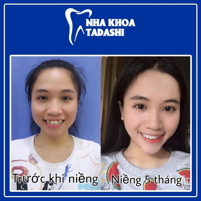 Hình ảnh tại Nha Khoa Quốc Tế Tadashi