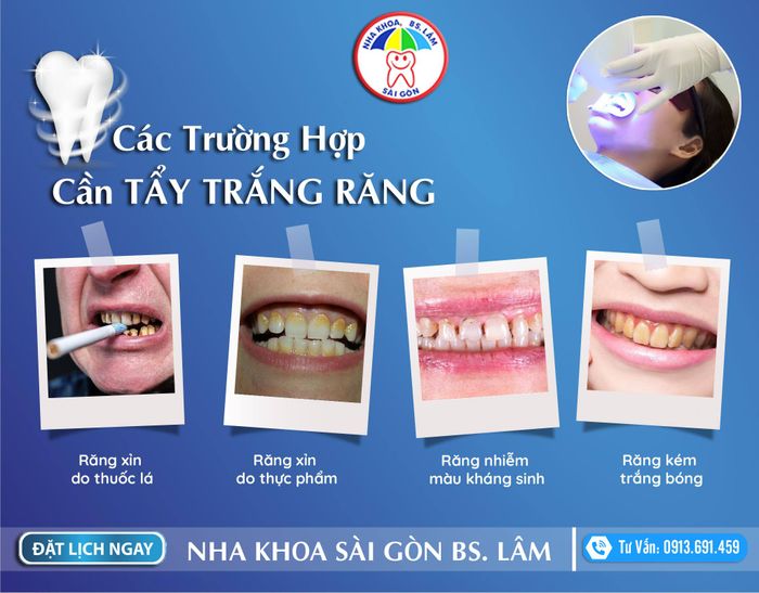 Nha Khoa Sài Gòn Bác Sĩ Lâm hình ảnh 2