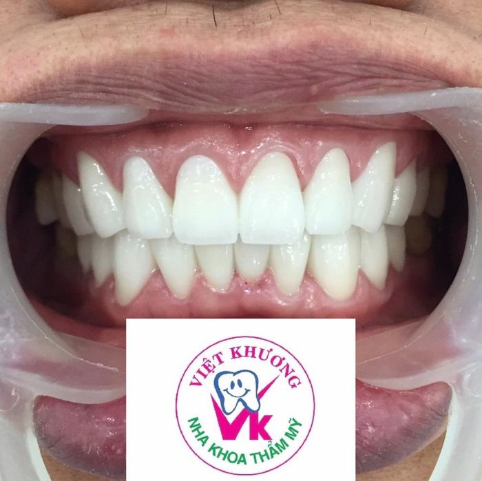 Nha Khoa Việt Khương - Hình ảnh 1