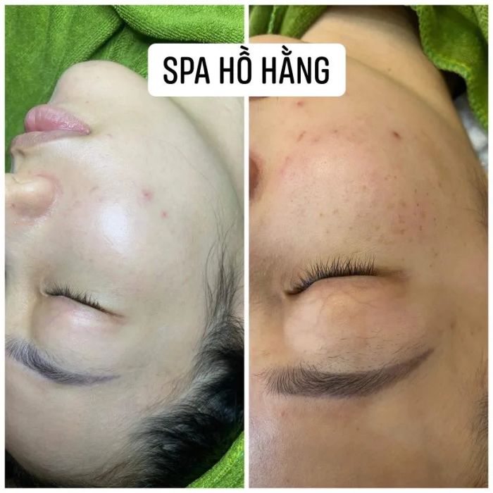 Spa Hồ Hằng ảnh 2