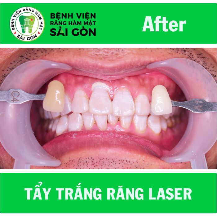 Bệnh Viện Răng Hàm Mặt Sài Gòn hình ảnh 1