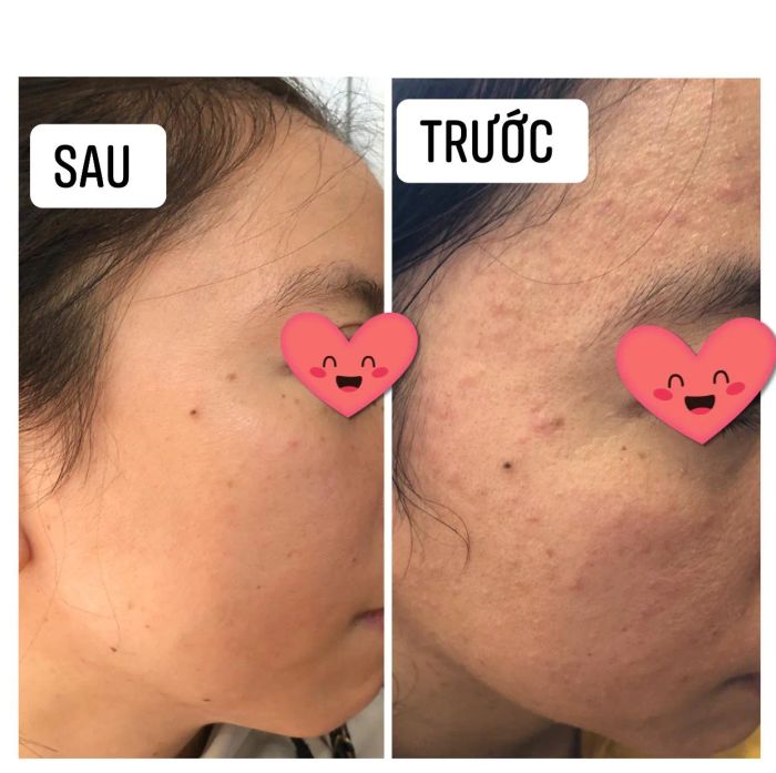 Dr. Ngọc Anh - Da liễu và Thẩm mỹ ảnh 2