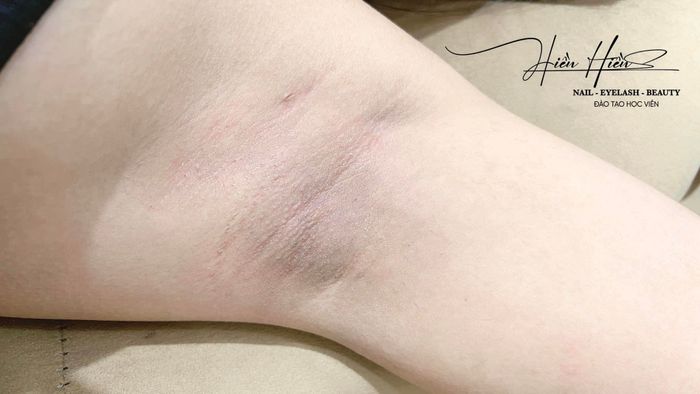 Quy trình waxing chuyên nghiệp tại Hiền Hiền Beauty