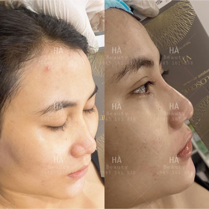 Không gian sang trọng và hiện đại tại Hà Beauty & Spa