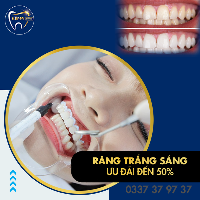Hình ảnh thực tế tại Nha Khoa HAPPY