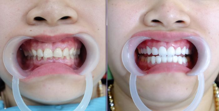 Nha Khoa Quốc Tế Việt Pháp ảnh 1