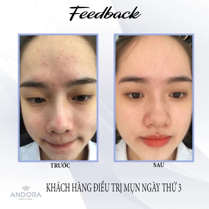 Andora Beauty & Clinic hình ảnh 2