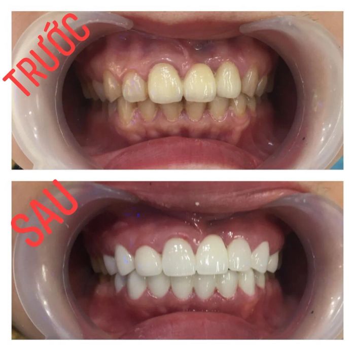 NHA KHOA KHOA ĐẠT - Địa chỉ đáng tin cậy cho sức khỏe răng miệng
