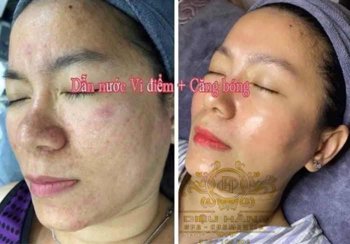 Không gian trị liệu cao cấp tại Diệu Hằng Spa